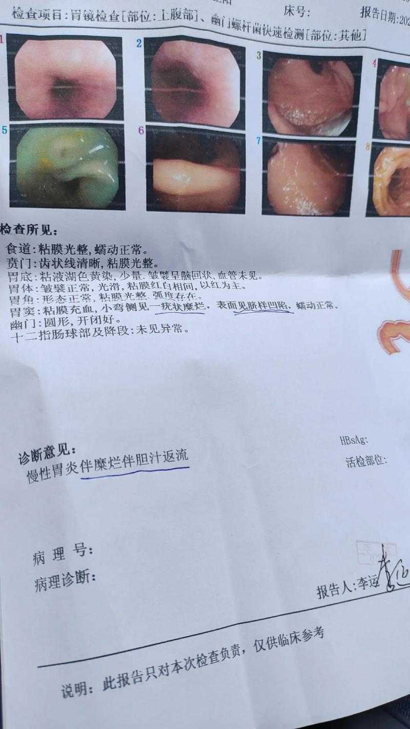 胃镜进十二指肠降部技巧,快递单号查询_123随叫随到