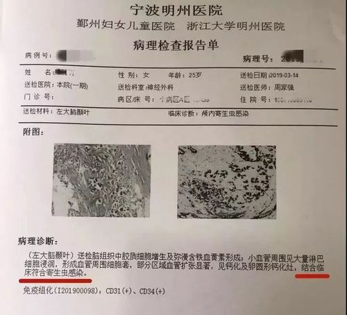 颅内寄生虫活8年,专业的一站式物流信息网_123随叫随到